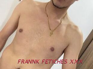 FRANNK_FETICHES_XXX